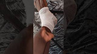 Kuppi chillu kuthi leg injury aayappol😱 #shorts #youtubeshorts #youtube #ytshorts