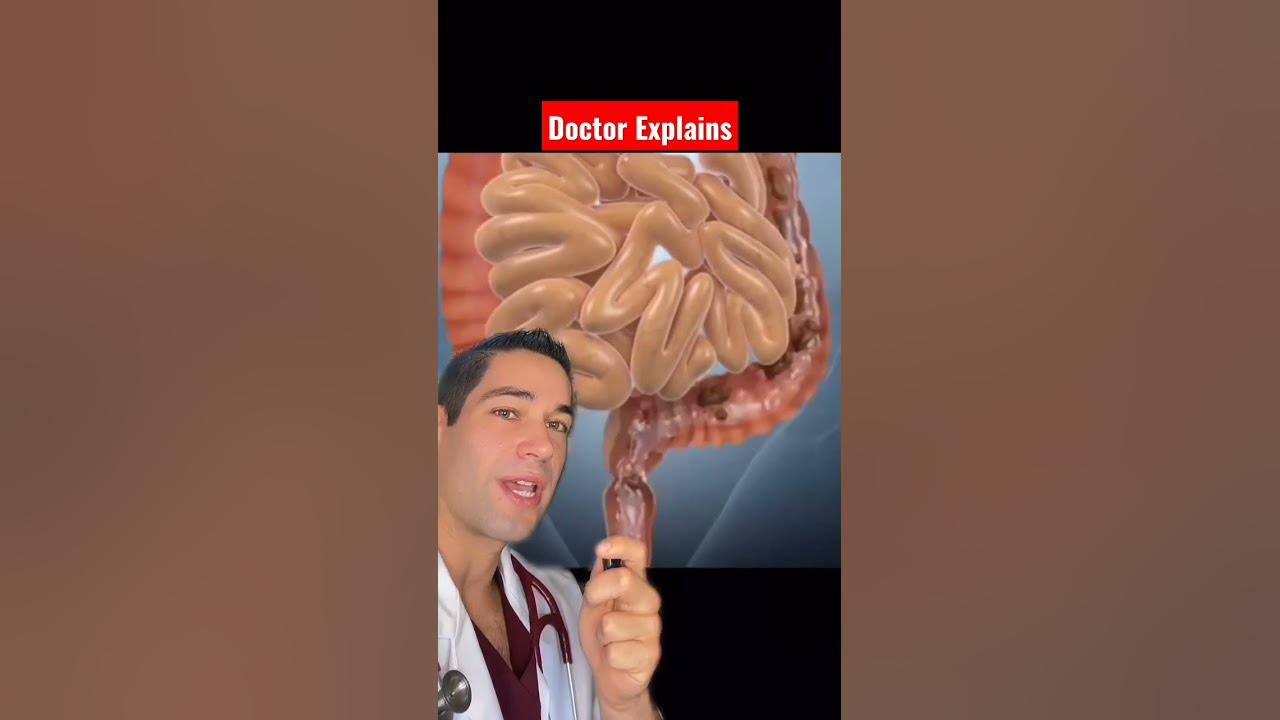 Problems with an Enema? #Doctor #shorts