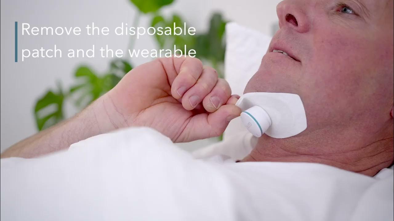 Using genio as the cpap alternative for obstructive sleep apnea youtube