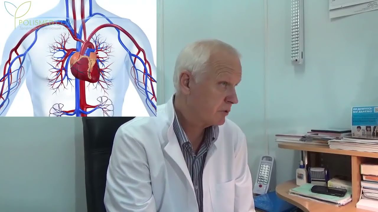 Хламидиоз - определение, инкубационный период, симптомы - YouTube