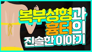 유연한 의사들 [복부성형 편] 비키니라인과 흉터