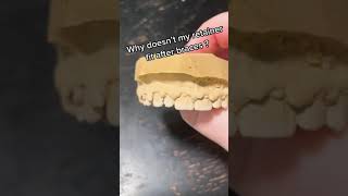 Famous Why doesn’t my retainer fit after braces 😬 Profile