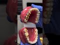BRACES vs Lotus COOKIES !! ASMR orthodontist food stuck between brushing teeth