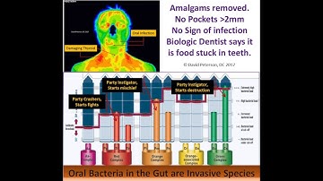 Why Are You Using The SIBO Breath Test?