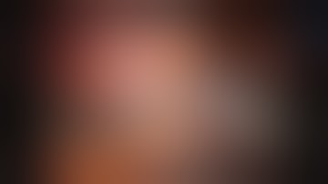 Current technique and results for extended PLND during RALP: 1.Exposure