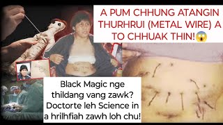 Download lagu A pum atangin thirhrui (metal wire) a rawn to chhuak !😮😮😲 I awih zawng a ni em!?