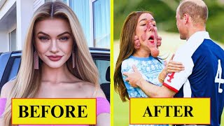 15 Plastic Surgery Disasters That Left Celebrities Unrecognizable | Then and Now 2025