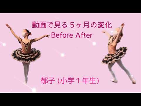 バレエ上達サポート【 Before After 】野間 彩 バレエ教室《芦屋》