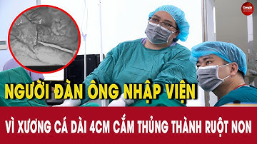 Người đàn ông nhập viện vì xương cá dài 4cm cắm thủng thành ruột non | PHÁP LUẬT & CUỘC SỐNG