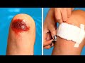 SAFETY HACKS AND FIRST AID 😰 | TRUQUES DE PRIMEIROS SOCORROS | Dicas DIY e Situações Divertidas