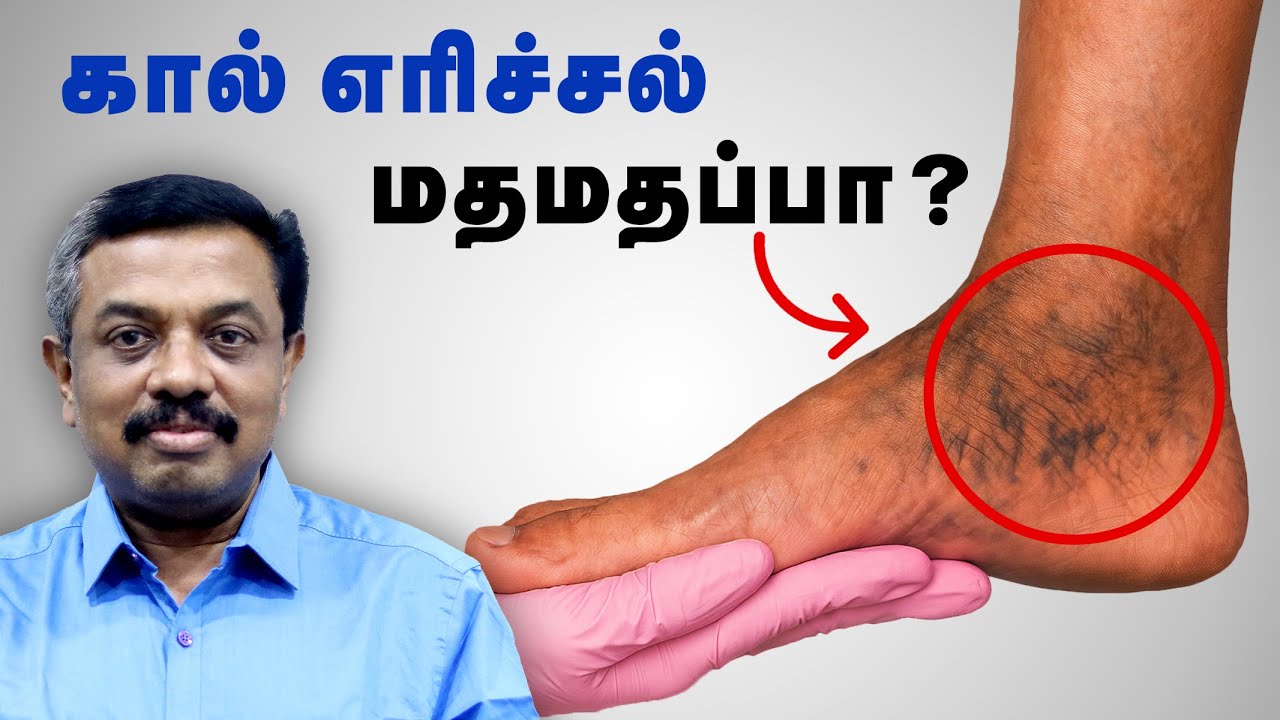 3 வருட கால் எரிச்சல் மதமதப்பு குணமானது! Diabetes Tips in Tamil