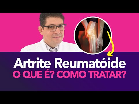 O que é a Artrite reumatoide, como tratar? | Dr Juliano Teles