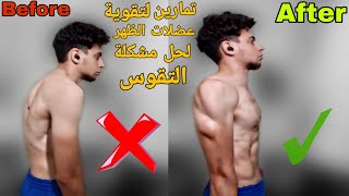 تمارين لتقوية عضلات الظهر للحماية من التقوس ( الاتب )