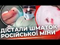 Лікарі здійснили диво..У серці 4-річної дівчинки з Херсона застряг уламок російської міни