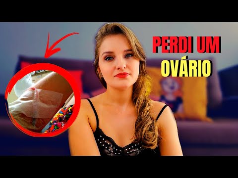 Vídeo: Duphaston Com Um Cisto Ovariano: Instruções, Regime De Dosagem, Conselho Médico