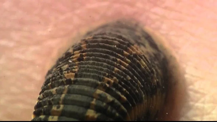 Shape of Life: Annelids - Leeches
