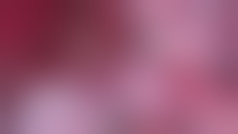 Giant MCA aneurysm, microsurgical clipping. Dr. Tural Hidayetov