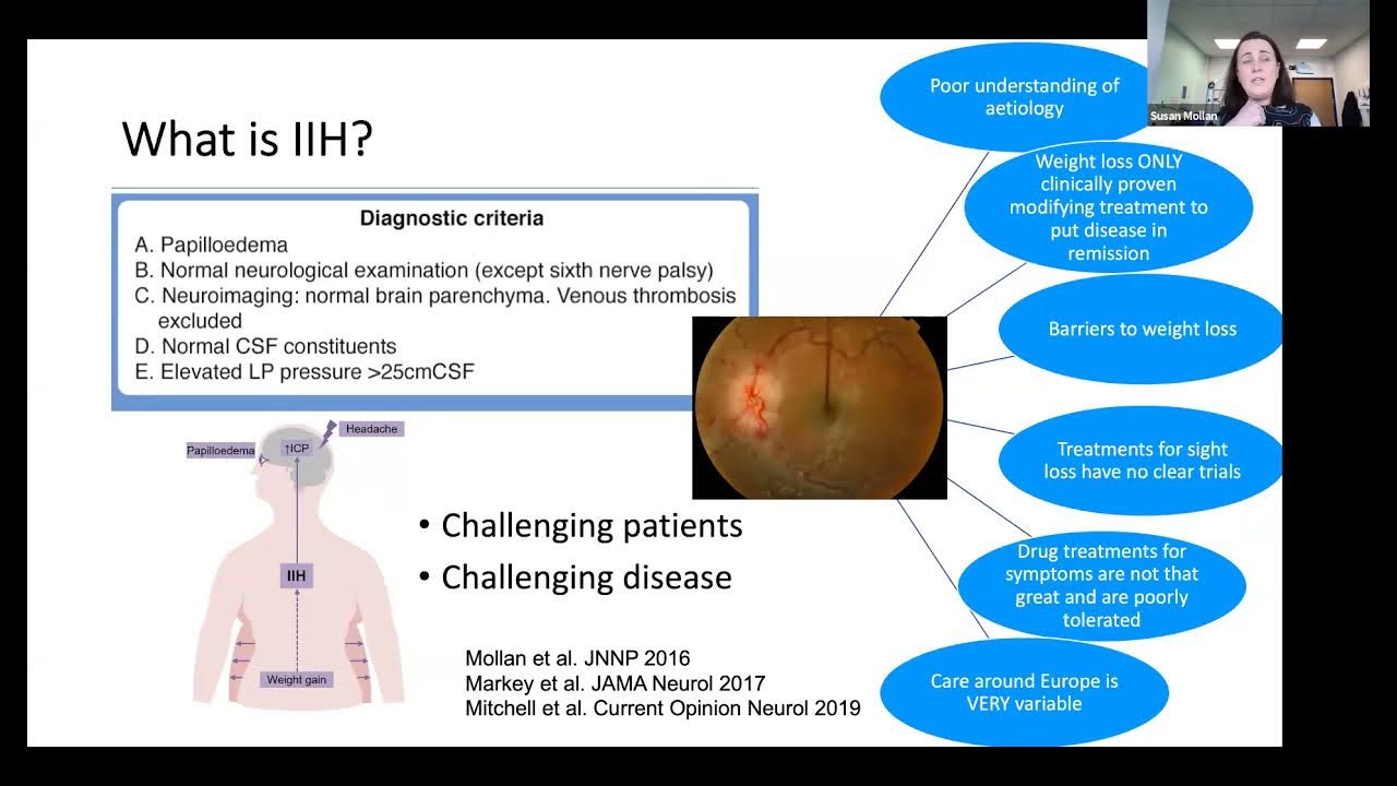 idiopathic-intracranial-hypertension-pathophysiology-and-csf