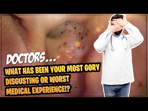 Doctor Share their Most Gory Disgusting Experience | Doctors | r/askreddit | Reddit Professionals
