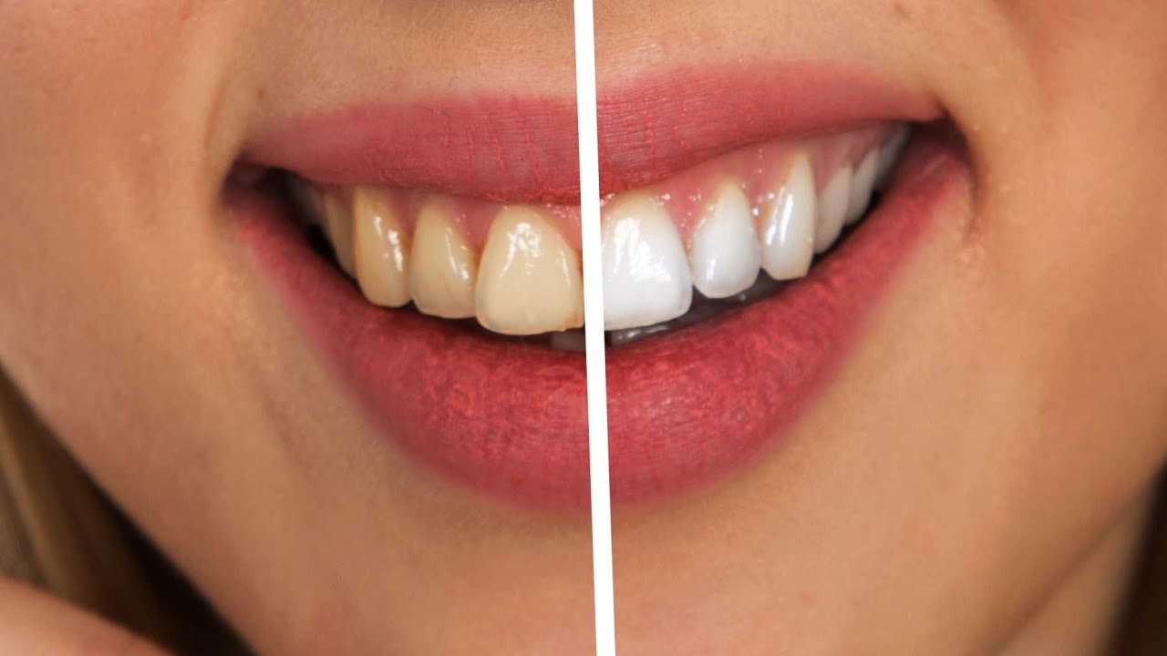How to care your teeth in simple way