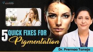 5 Quick Fixes for Pigmentation | Clinic Eximus Diet For Hyperpigmentation Clear Skin Secrets Clinic Eximus