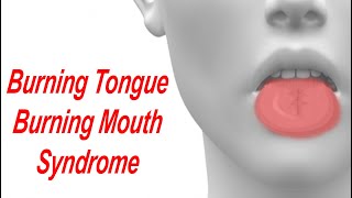 Burning Tongue and Burning Mouth Syndrome: Causes and Treatment