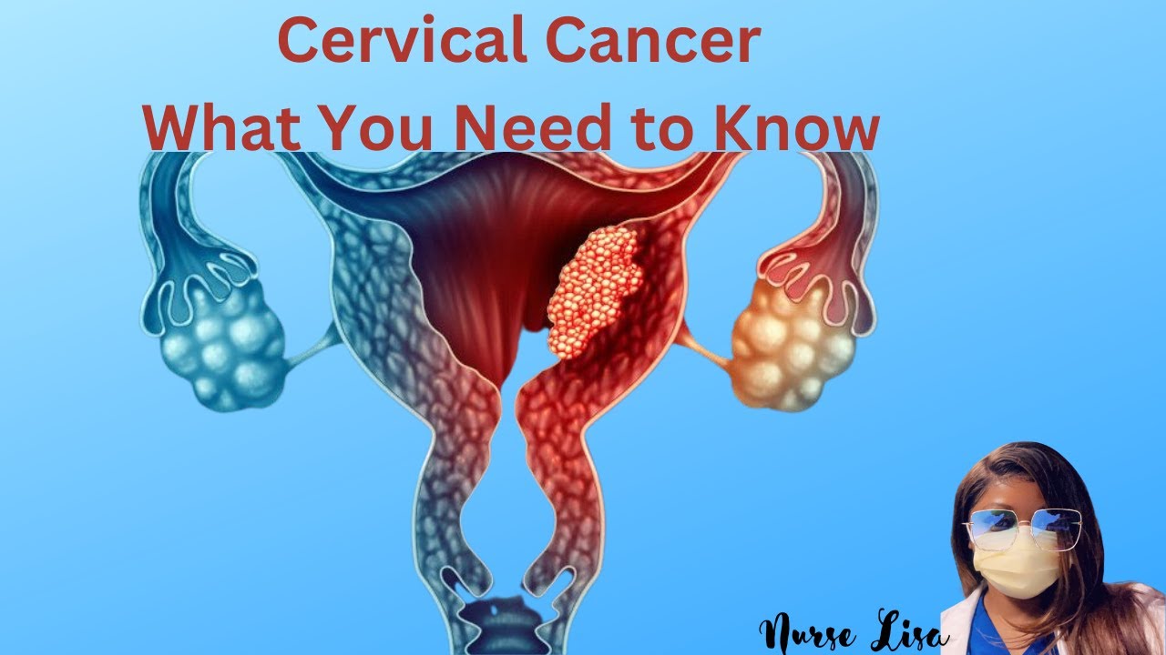 Did You Know that Cervical Cancer can be Sexually Transmitted? - YouTube