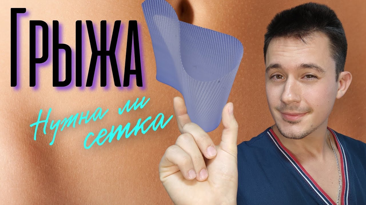 Грыжа живота (паховая, пупочная, послеоперационная) Нужна ли сетка?