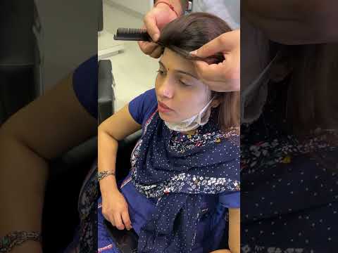 Hair Topper Patch For Baldness 100 Natural Permanent Option Loss Xpressions Salon