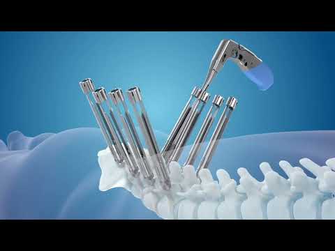 Medtronic | CD Horizon Solera Voyager & Artic-L 3D TI