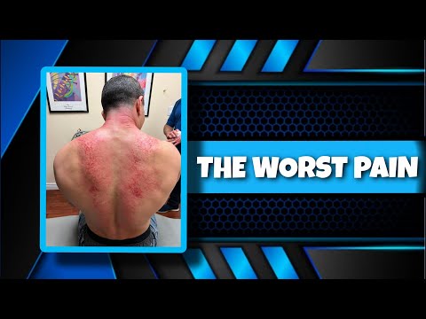 Build Muscle With GUA SHA Treatment (WORST PAIN EVER!)