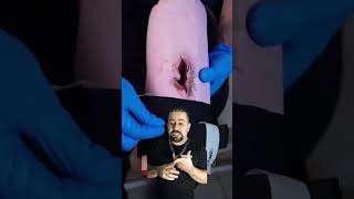🚨 O ERRO FATAL AO COLOCAR DOIS TORNIQUETES! #saúde #curiosidades #medicina #curiosidadesmédicas