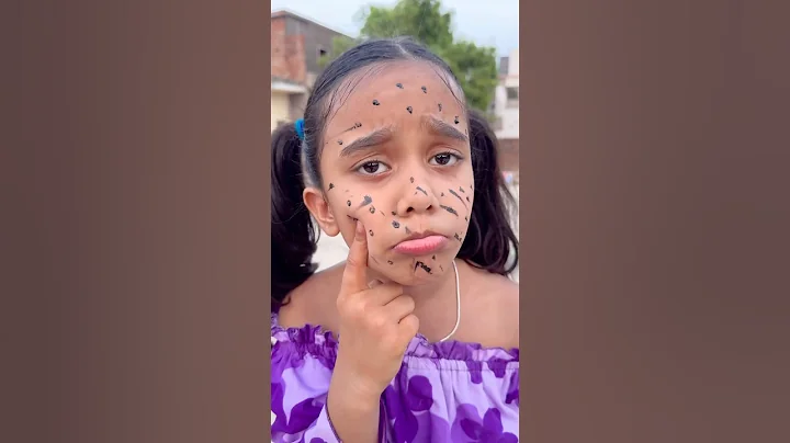 Amaira ke face pr y kya ho gya #amairagurjar #shorts