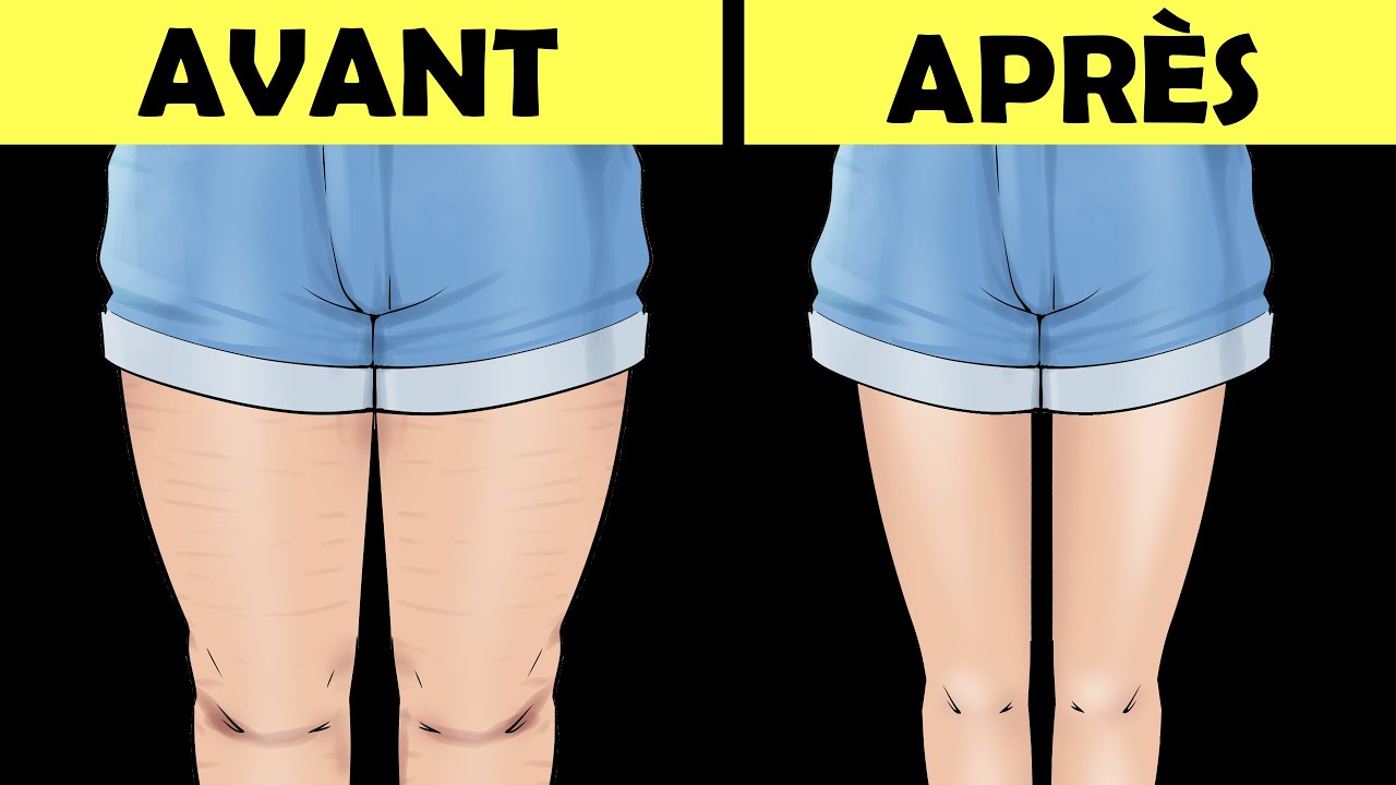 Comment Faire Pour Avoirs Des Jambes Fine