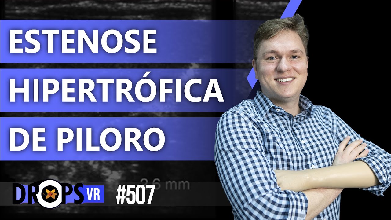 ACHADOS DE ESTENOSE HIPERTRÓFICA DE PILORO NO ULTRASSOM - YouTube