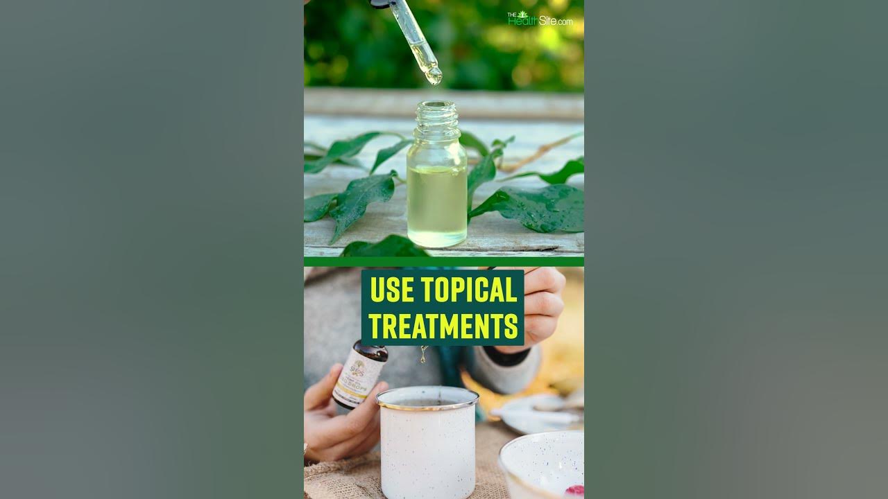 How To Treat Boils At Home !! Home Remedies YouTube