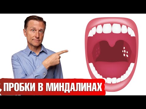 Видео: Как предотвратить возвращение бактериального вагиноза: 12 шагов