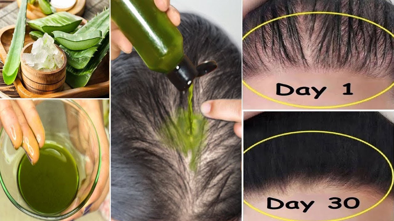 This Aloe Vera Trick Turned My Bald Hair to Thick Hair in 30 Days ...