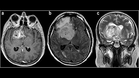 MRI Application training Brain without contrast