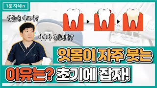 잇몸이 붓는 이유는 무엇일까요?! 계속해서 잇몸이 붓는다면?