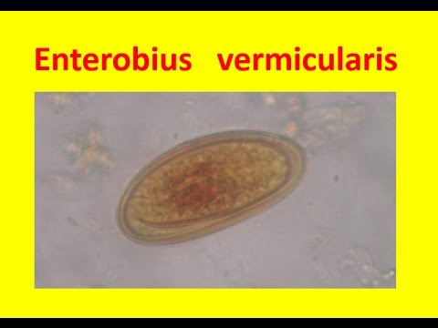 Oxiuros donde se encuentran, Enterobius vermicularis donde se encuentra - p5net.ro