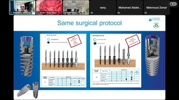 Exclusive Webinar Replay: DESS® Implants in Practice