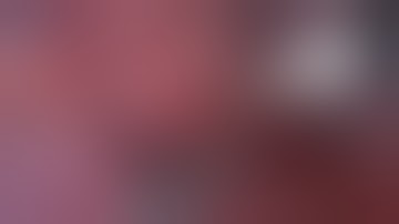 Asvide: The video depicts a single-direction VATS left S9+10 segmentectomy. The operation ...