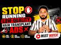 Why 99% Hair Transplant Clinics Get Junk Leads From Meta & Google Ads | Gaurav Dubey
