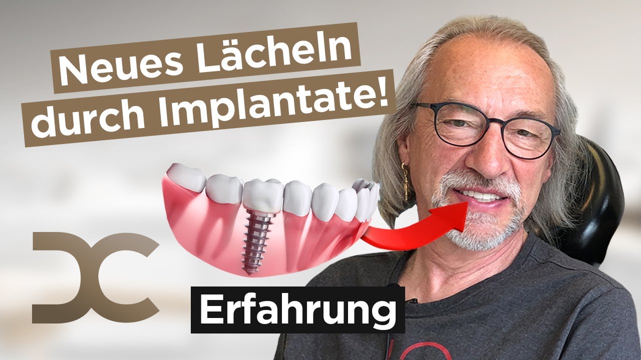 Erfahrung implantat zahn Implantatgetragene Verbundbrücke