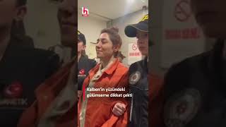 Şarkıcı Kalben'in adliyeye sevk edilirken yüzündeki gülümseme dikkat çekti! Resimi