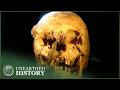 The Medieval Skull That Revealed A 600 Year Old Disease The Medieval Skull That Revealed A 600 Year Old Disease