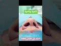تضييق فتحات الأنف ب مخدر موضعي 
