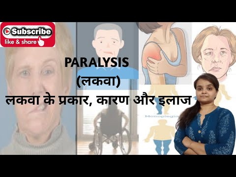 PARALYSIS ll symptoms, causes, treatment ll
