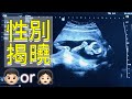 懷孕最期待的事之一｜👶🏻性別｜寶寶日記Baby diary｜山繆與喬伊 |JoyVLife